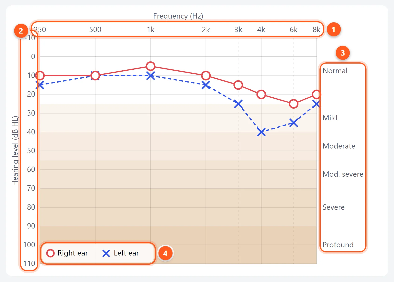 An example audiogram result with the frequency axis, the hearing level axis, the hearing loss bands and the per-ear averages labeled